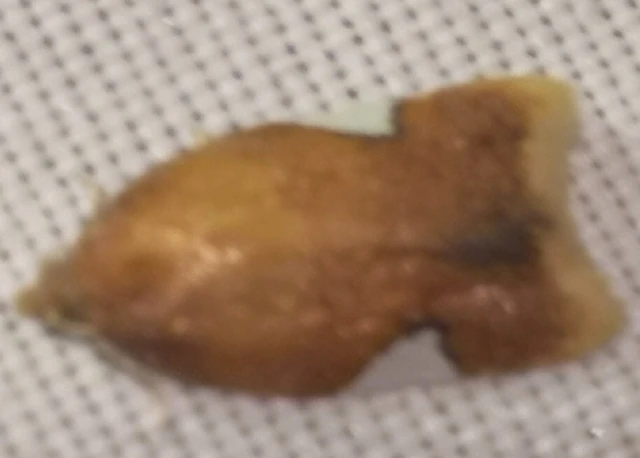 Acleris holmiana - fehérfoltos levélmoly
