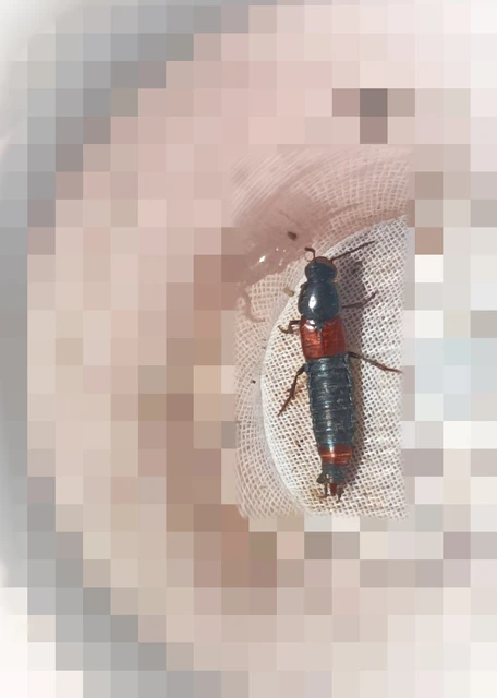 Astrapaeus ulmi - pirosöves mohaholyva